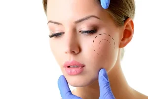 bichectomia clinica mg dental