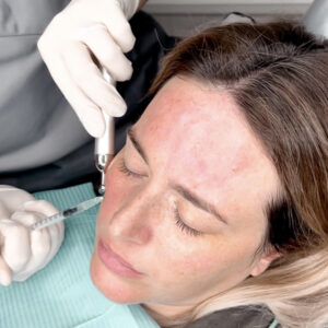 mesoterapia clinica mg dental
