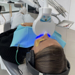 blanqueamiento dental clinica mg dental