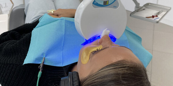blanqueamiento dental clinica mg dental blanqueamiento dental clinica mg dental