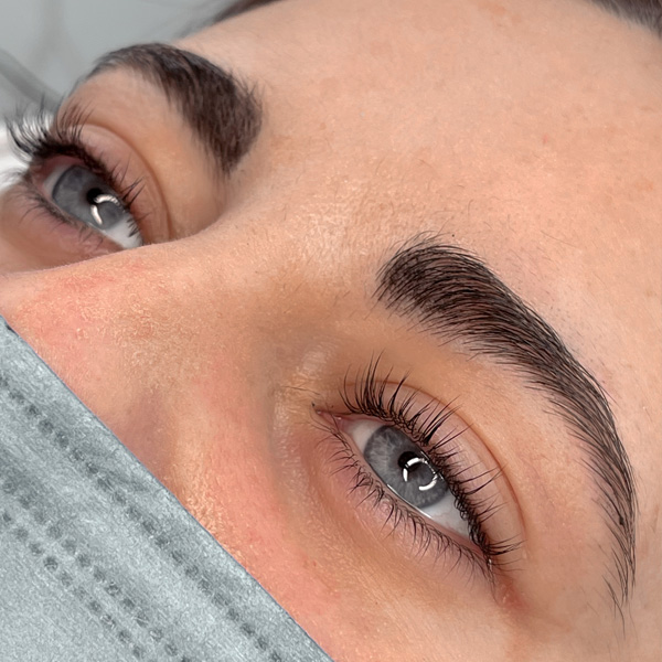 Laminado de Cejas • CLÍNICA MG DENTAL