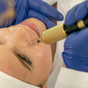 HYALURON-PEN-CLINICA-MG-DENTAL
