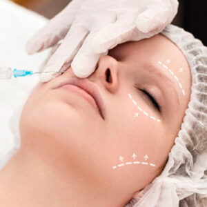 radiesse clinica mg dental