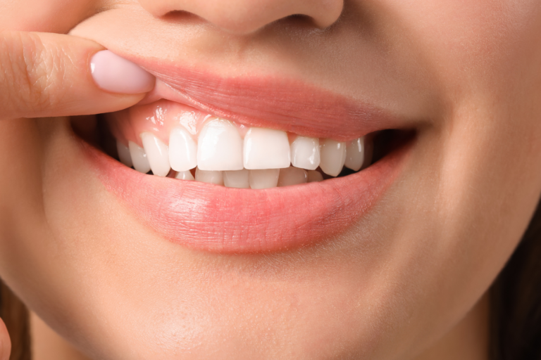 ¡Mantén tus encías siempre sanas!